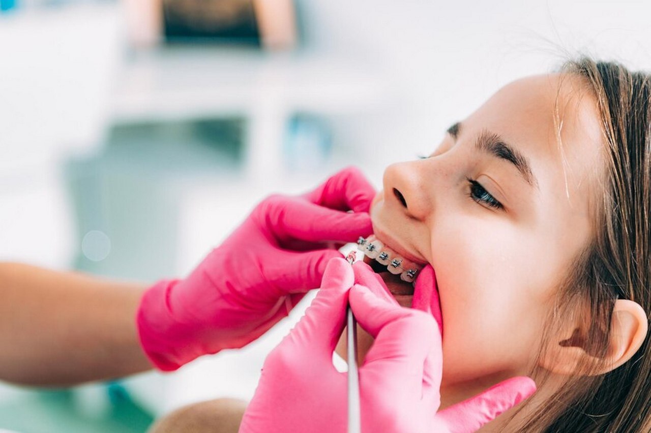 leczenie ortodontyczne u dzieci